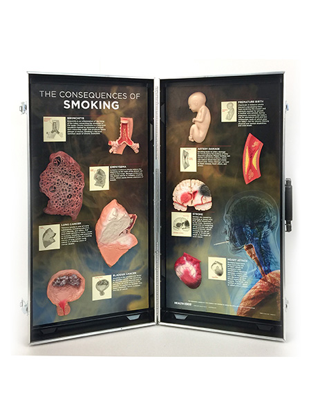 Smoking Consequences 3-D Display