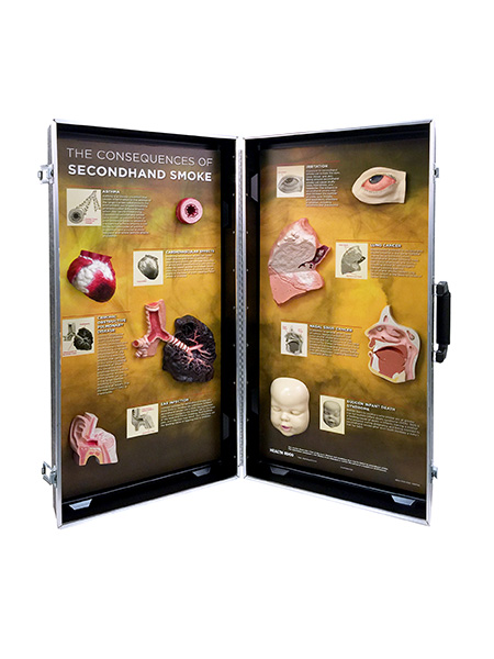 Secondhand Smoke Consequences 3-D Display